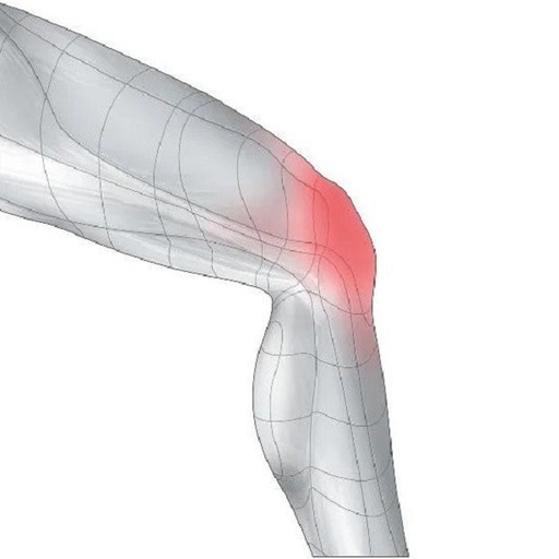 زانوبند طبی سنسی‌پلاست Knee Brace GENUA ACTIVE